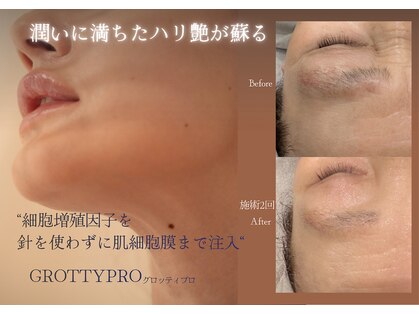 ワイビューティ(Y.Beauty)の写真
