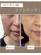 けいのき鍼灸整骨院の写真/年齢を重ねるごとに気になるお肌のお悩みを改善！鍼施術でお肌の内側からアプローチし美しく♪ハリツヤUP！