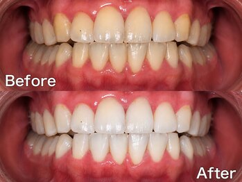 バイエムディーシー(by MDC)/【Before / After】
