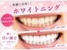 【9/13.14.15限定】セルフホワイトニング(9分2セット)1回￥5980→￥1980