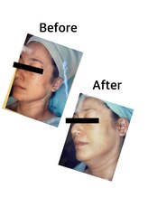 エスティ 京都店/☆