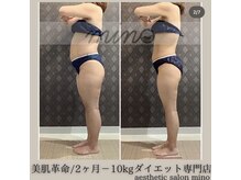 ミノ 美里大通り店(mino)/ダイエットパッケージ