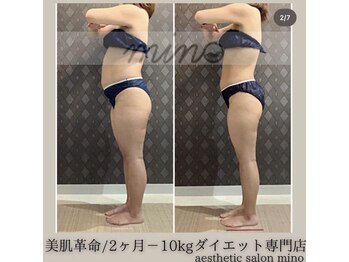 ミノ 美里大通り店(mino)/ダイエットパッケージ