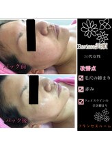 エステ フランセスルーム/ラヴィーサフェイシャル