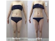 メゾン アンジュ(Maison Ange)/痩身コース/before&after