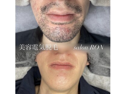ロン(RON)の写真
