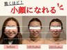 【超小顔★】NR小顔矯正＋肩甲骨はがし《歪み/二重顎/たるみ改善/むくみ》