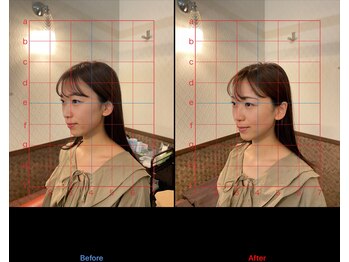 チャチャエイム整骨院 鍼灸院/美容鍼ビフォーアフター
