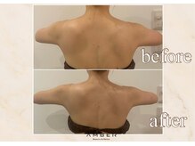 アンバー 恵比寿(AMBER)/ドレスが映える後ろ姿に…☆