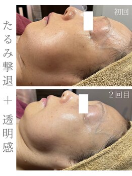 シストワ(sistoi)/理想のフェイスラインを叶えます