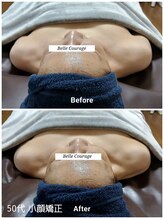 ベルクラージュ(Belle Courage)/50代　小顔矯正・巻き肩