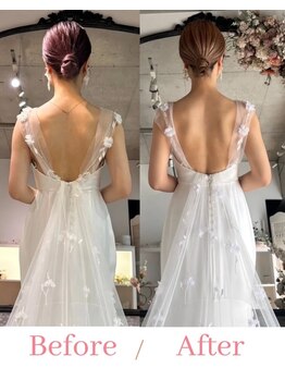 すみれ鍼灸整骨院/神戸 ブライダル美容整体