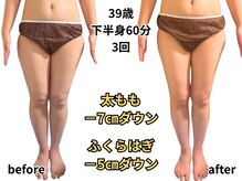 アルピナ(ALPINA)/下半身サイズダウン例