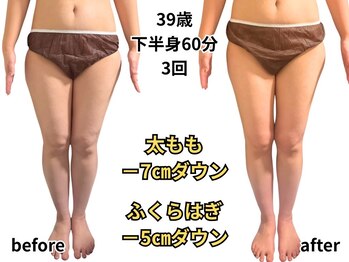 アルピナ(ALPINA)/下半身サイズダウン例