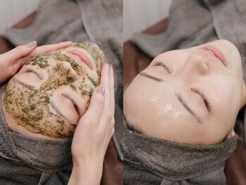 フォア(foi)/ピーリング後肌艶増し