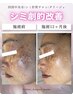 【気になるシミ・くすみに】白玉プレミアム＋ポレーション90分20,000円→