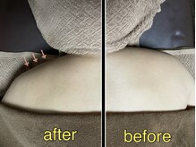 カドゥルエクラ(Cuddleclat)/BODY　Before→After