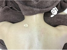 トータルエステサロン エステアンドメイク 錦糸町/SNSで話題の次世代型痩身