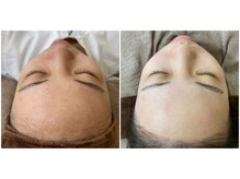 アイビー(eyebee)/パーツワックス1500円～