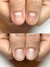 マリーロール 淀屋橋本店(Marie Laure)/自爪育成/深爪矯正/ネイルケア