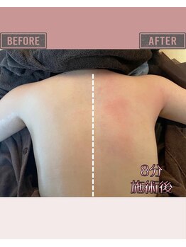 マーリエ(Malie)/【オールハンド】背中・肩周り