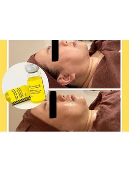 小顔になりたい