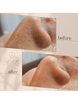 お肌をきれいにしたい