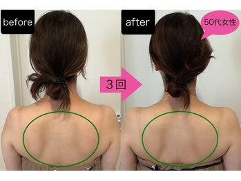 イーリス(i-ris)/美容整体×肩甲骨剥し×小顔矯正