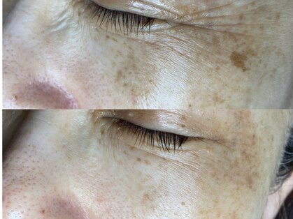 ソワラ(Soiela)の写真