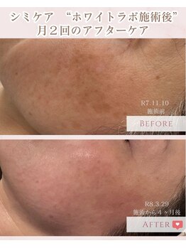 エクラ アン(eclat.un)/ホワイトラボ