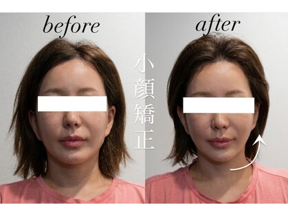 ボディプラストウキョウ 表参道店(BODY PLUS TOKYO)の写真
