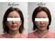 ボディプラストウキョウ 表参道店(BODY PLUS TOKYO)の写真
