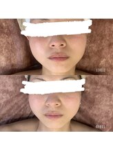 ベル(Belle)/BBLフェイシャル