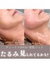 【初夏6/9～14限定】最強リフト!国際特許◆ヴィーナスDIVA+美肌パック