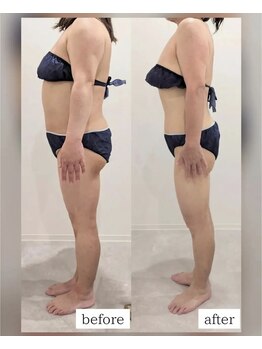 リアージュ(Riage)/お客様の変化