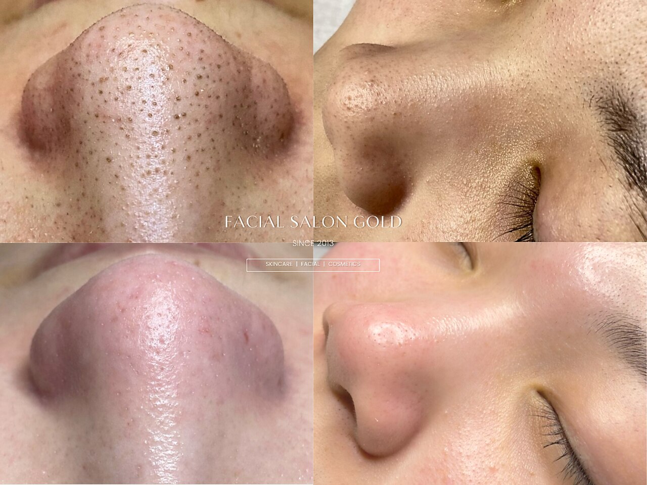 ゴールド 栄店(GOLD)｜ホットペッパービューティー