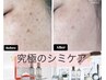 【小顔シミケア×水光肌】光フォト＋ララピール(ララピール専用パック付き)
