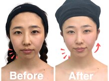 小顔フェイスラボ 一宮店(小顔 Face Labo.)