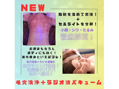 ビービー(BB)の写真