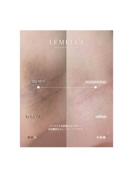 ピュアソル 奈良店(Puresol)/ルメラ