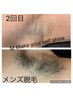 【モニター脇脱毛】メンズレディース両ワキ3回 ¥9,000→¥1,980