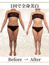 ドレス(dress)/全身痩身Before/After
