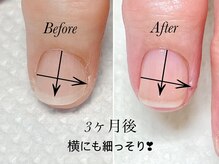 トゥインクリーネイルサロン(Twinkly Nail Salon)/【最強のネイルケア】1回お試し