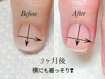 トゥインクリーネイルサロン(Twinkly Nail Salon)/【最強のネイルケア】1回お試し