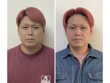 寝屋(neya)/小顔矯正比較