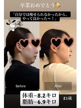 リンドール(RinDoll)/２０歳耳つぼダイエット卒業