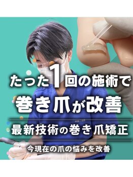 西町通り整骨院/巻き爪矯正