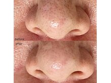 ライズ 札幌店(RISE)の雰囲気（《ハイドラフェイシャル》で普段落とせない汚れを除去☆）