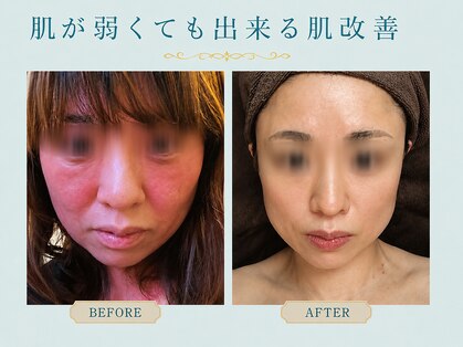ウー 上熊本(WOO)の写真