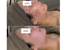 ウィム(whim)の雰囲気（サロントリートメントとホームケアで、自分に合う肌質改善を）